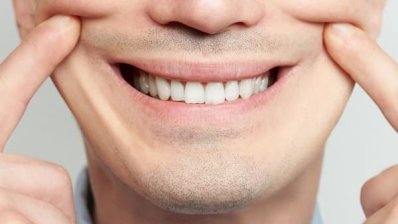 ۵ تمرین برتر صورت برای فلج بلز
