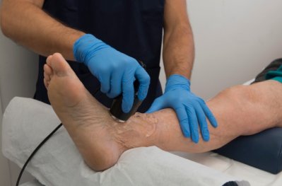 فیزیوتراپی پیچ خوردگی مچ پا (Ankle Sprain)