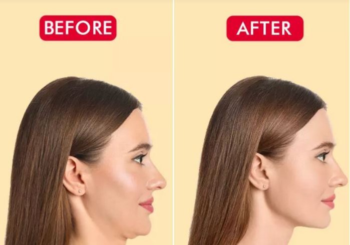 10 تمرین گردن برای از بین بردن چانه دوتایی یا غبغب